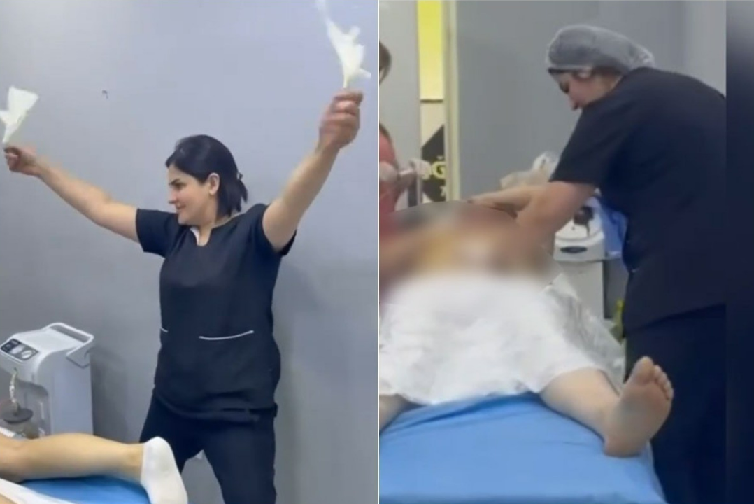 Qanunsuz estetik əməliyyat aparan kosmetoloq cərimələndi